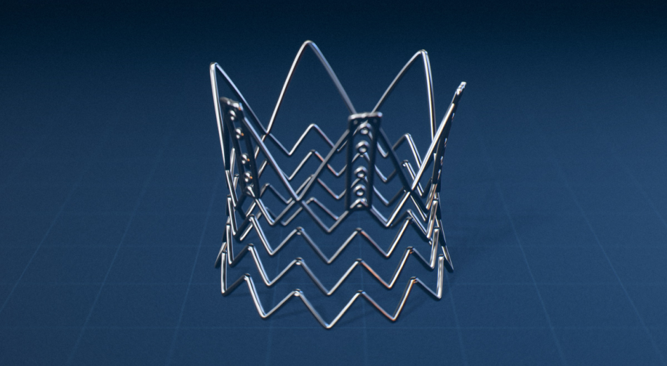 Illustrative valve-frame concept with complex metal geometry